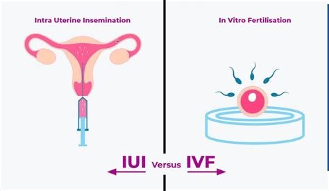 Artificial İnsemination Vs İn Vitro Fertilization