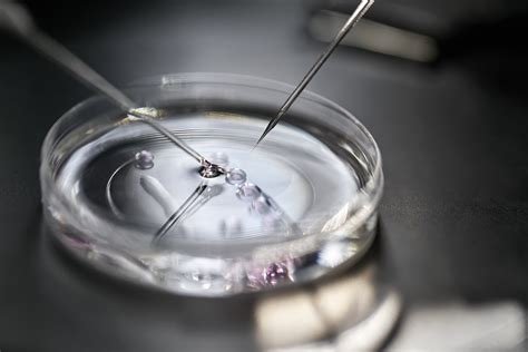 Cheap İn Vitro Fertilization
