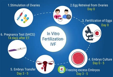 How Much For İn Vitro Fertilization