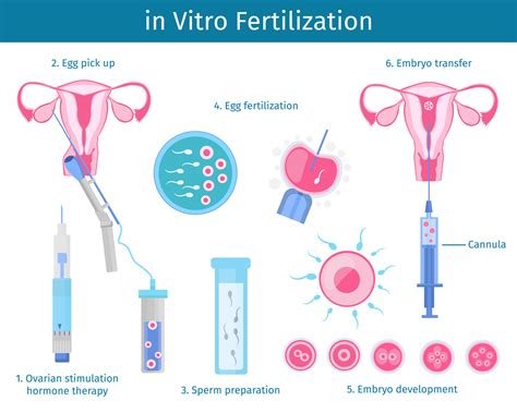 İn Vitro Fertilization En Español