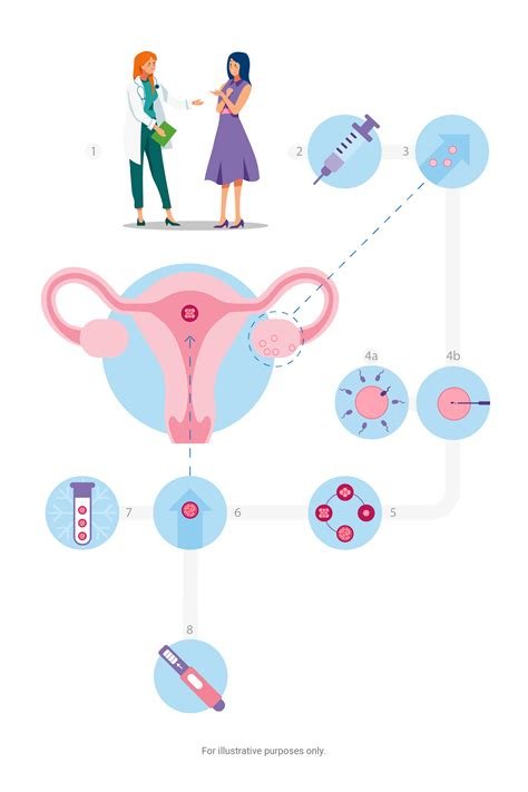 Kaiser Permanente İn Vitro Fertilization Cost